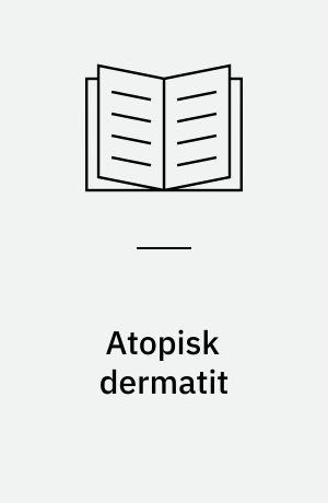 Atopisk dermatit