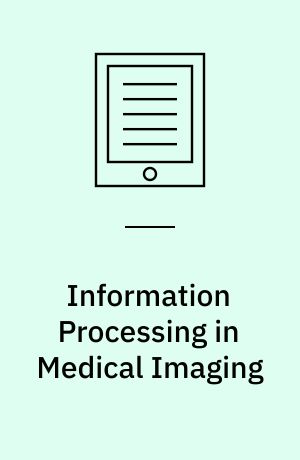 Information Processing in Medical Imaging : 15th International Conference, IPMI'97, Poultney, Vermont, USA, June 9-13, 1997, Proceedings