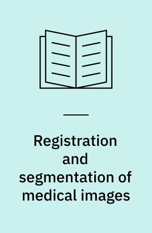 Registration and segmentation of medical images