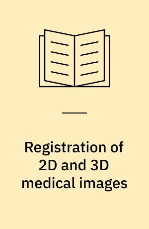Registration of 2D and 3D medical images