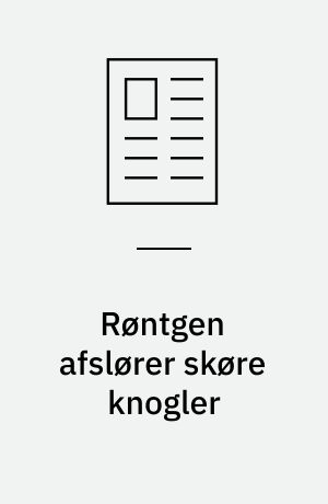 Røntgen afslører skøre knogler : medikoteknik
