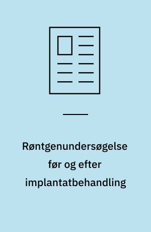 Røntgenundersøgelse før og efter implantatbehandling