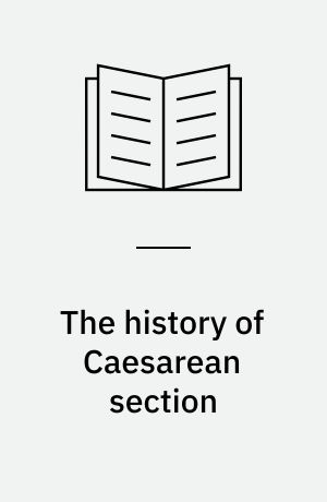 The history of Caesarean section
